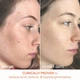 Пилинг для лица Dr. Dennis Gross Skincare Alpha Beta Universal Daily Peel - изображение 2