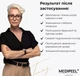 Відновлювальний крем для шкіри навколо очей Medi-Peel Cell Toxing Dermajours Repair Eye Cream 30 мл - зображення 4