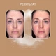 Предпилинг Health Peel 8% 30 мл (4820208890199) - изображение 7
