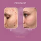 Гликолевый пилинг Health Peel 40% pH 1.6 30 мл (4820208890151) - изображение 7