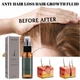 Флюїд для росту волосся Eelhoe Anti-Hair Loss Hair Growth Fluid, 30 мл - изображение 2