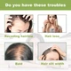 Флюїд для росту волосся Eelhoe Rosemary Mint Scalp & Hair Strengthening Oil, 60 мл - изображение 4