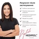 Киснева есенція Medi Peel Peptide 9 Volume All-in-One Essence Pro, 100 мл - зображення 7