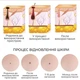 Лазерная ручка для удаления Swan Beauty DZ-01 для удаления папилом и бородавок, аппарат косметологический портативный Золотистый 078m - изображение 3