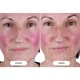 Светодиодная маска CurrentBody Skin LED Light Therapy Face Mask: Series 2 нового поколения - изображение 6
