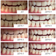 Відбілювальні смужки Medica+ 3DWhite Strips - зображення 7