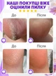 Электрическая роликовая пилка пемза для ног и пяток аккумуляторная Electric Callus Remover с LCD дисплеем и функцией самоочистки + большой комплект по уходу за ногами - изображение 9
