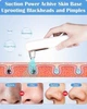 Професійний вакуумний очисник пор для видалення чорних цяток Yccu Blackhead Remover Y002 - изображение 2