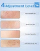 Професійний вакуумний очисник пор для видалення чорних цяток Yccu Blackhead Remover Y002 - изображение 3