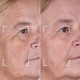 Светодиодная маска CurrentBody Skin LED Light Therapy Face Mask: Series 2 нового поколения - изображение 11