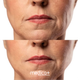 Микротоковый RF лифтинг массажер для лица Medica+ Skin Lifting 7.0 (Ems+Led) pink ( Япония ) - изображение 5