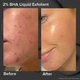 Отшелушивающее средство Paula's Choice Skin Perfecting 2% BHA Liquid Exfoliant 118 ml - изображение 3