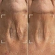 Светодиодная маска CurrentBody Skin LED Neck and Dec Perfector для шеи и декольте: Series 1 - изображение 4