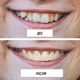 Косметичні накладки на зуби Imako Premium Cosmetic Teeth натуральний білий колір - зображення 6