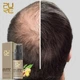 Спрей для росту волосся Pure Hair Growth Spray 30 мл Імбир Женьшень Горець Натуральний веганський засіб - зображення 8