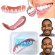 Накладні вініри для зубів Perfect Smile Veneers - зображення 4