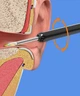 Прибор для чистки ушей с эндоскопической камерой Ear Cleaner Черный - изображение 5
