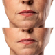 Мікрострумовий RF Lifting Масажер для обличчя Skin Lifting 7.0 White - EMS, LED - зображення 12