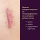 Силиконовый пластырь от шрамов и рубцов Mederma Silicone Scar Sheet Маленький (4х8 см) - изображение 9