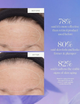 Сироватка для обличчя Kora Organics Plant Stem Cell Retinol Alternative антивікова 30 мл (9342759006102) - зображення 4