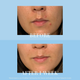 Гель для обличчя Kate Somerville EradiKate Acne Mark Fading 30 мл (810023370543) - зображення 4