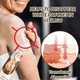 Зволожуючий крем для освітлення білих плям від вітіліго Vitiligo Removal Cream, 20г - зображення 3