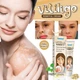 Зволожуючий крем для освітлення білих плям від вітіліго Vitiligo Removal Cream, 20г - зображення 4