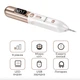 Электрокоагулятор Swan Beauty Smart Pen S60 для удаления папиллом бородавок сосудистых звездочек портативная ручка коагулятор для устранения рубцов постакне новообразований золотистий - изображение 4
