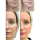 Микротоковый RF Lifting Массажер для лица Skin Lifting 7.0 White - EMS, LED - изображение 14