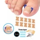 Набор для коррекции врастающих ногтей Elastic Toenail Correction Sticker 50 шт Бежевый (2104618421) - изображение 3