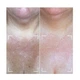 Набор CurrentBody Skin LED Light Therapy Face Neck Kit: Series 2 для лица, шеи и зоны декольте - изображение 8