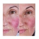 Набор CurrentBody Skin LED Light Therapy Face Neck Kit: Series 2 для лица, шеи и зоны декольте - изображение 9