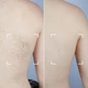 Лазерный эпилятор CurrentBody Skin Laser Hair Removal Device - изображение 8