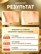 Фотоепілятор лазерний епілятор домашній IPL фотоепілятори з охолодженням шкіри для домашньої епіляції кварцовий для видалення волосся на ногах руках обличчі під пахвами в зоні бікіні безболісний - зображення 6