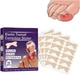Набор пластырей Elastic Toenail Correction Sticker для коррекции и устранения вросших ногтей (50 шт.) - изображение 1