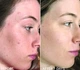 Пілінг-серветка для обличчя Dr. Dennis Gross Alpha Beta Universal Daily Peel набір - изображение 2