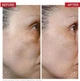 Пілінг для обличчя Dr. Levy Radical3 Reboot Pro Peel 50 мл - изображение 5