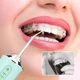 Ирригатор для полости рта 230 мл, с USB, Portable Oral Irrigator, Голубой / Портативный ирригатор для зубов - изображение 3