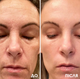 Инновационная сыворотка-заменитель ботокса Robeauty Argireline 30 мл - изображение 4