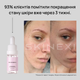 Лосьйон для проблемної шкіри від комедонів та чорних цяток Skinexi Soft Daily Lotion 15 мл - зображення 5