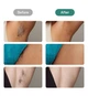 Фотоэпилятор ULIKE Air 2 IPL Dark Green с революционным охлаждением (наша уверенность – ваши 120 дней тестирования) - изображение 9
