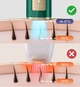 Фотоэпилятор ULIKE Air 2 IPL Dark Green с революционным охлаждением (наша уверенность – ваши 120 дней тестирования) - изображение 11