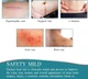 Силиконовый пластырь от рубцов и шрамов Silicone Scar Sheets - изображение 11
