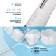 Ирригатор RZTK Dental Jet White - изображение 3