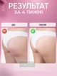 Вакуумный массажер от целлюлита с инфракрасным подогревом, банковый лимфодренажный массаж антицеллюлитный, Белый - изображение 5