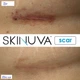 Крем від шрамів з факторами росту Skinuva Next Generation Scar Cream 30 мл - зображення 6