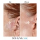 Крем від шрамів з факторами росту Skinuva Next Generation Scar Cream 30 мл - зображення 9