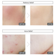 Заспокійливий крем Sur.Medic+ Azulene Soothing Cream з азуленом 50 мл - зображення 6