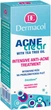 Крем для лица Dermacol AcneClear Intensive Anti-Acne Treatment интенсивный для проблемной кожи 50 мл (8590031104850) - изображение 2