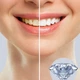 Відбілююча зубна паста Dr. Wild Emoform Diamond 75 мл - зображення 2